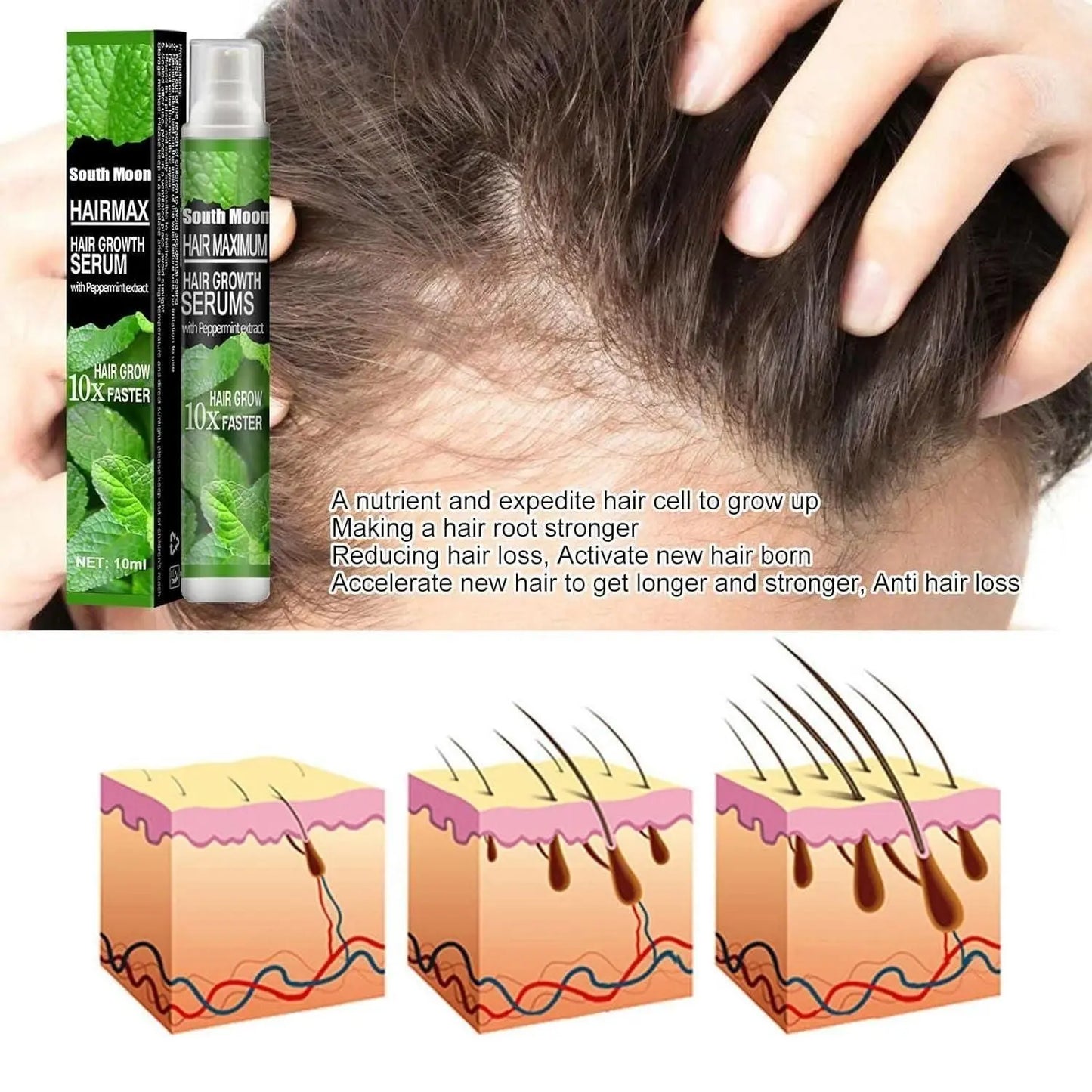 Ginger Plant Extract Anti-Hair Loss Hair Serum (Pack Of 3) Roposo Clout